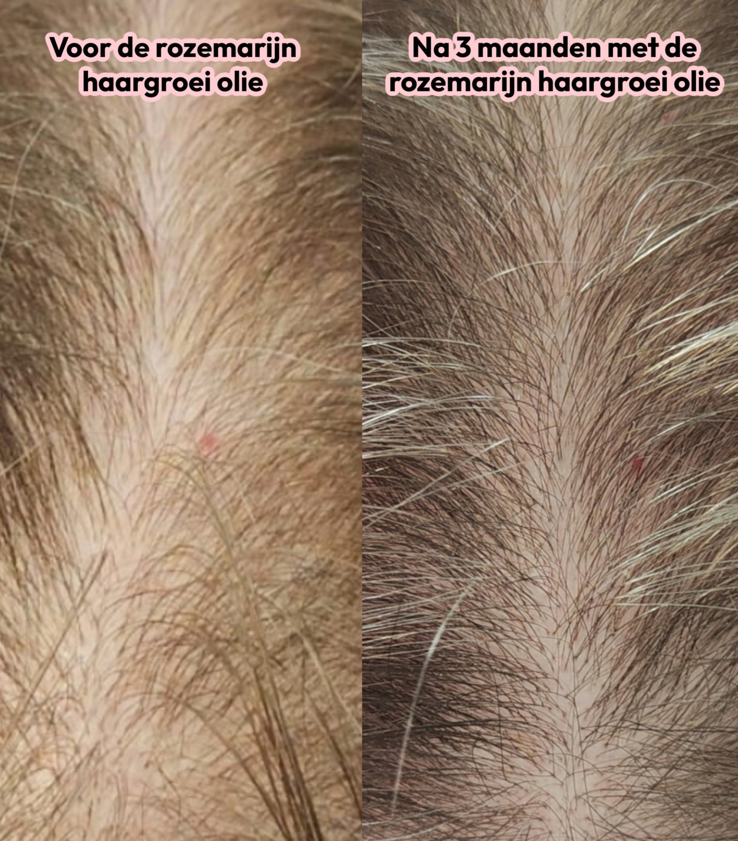 Rozemarijn haargroei olie (pre-order)